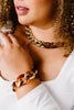 Gold & Tortoise Chunky Chain Necklace