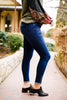Zip-a-Dee-Doo-Dah Skinny Jeans